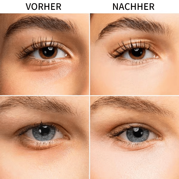 💖Augenaufheller, dunkle Augenringe abdecken und aufhellen