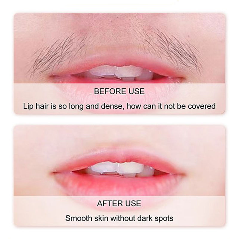 ⏳Begrenzte Zeit 50% Rabatt💥✨Sanfte & schmerzfreie Creme zur Haarentfernung im Gesicht
