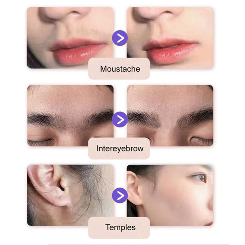 ⏳Begrenzte Zeit 50% Rabatt💥✨Sanfte & schmerzfreie Creme zur Haarentfernung im Gesicht